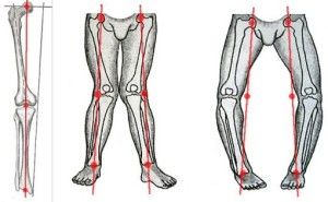deformirujushhij-artroz-kolennogo-sustava