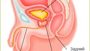 аденома простаты симптомы и лечение