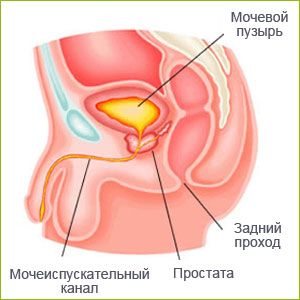 аденома простаты симптомы и лечение